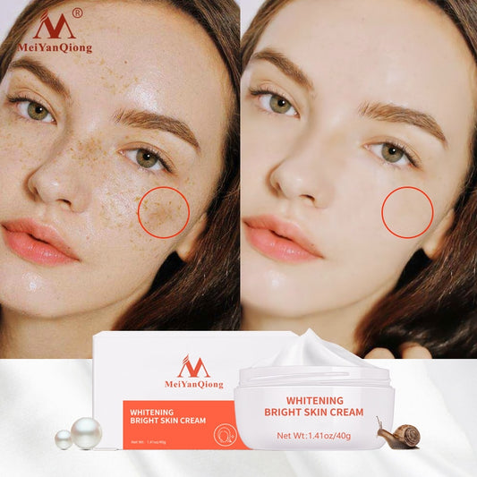 Powerful Whitening Freckle Cream Remove